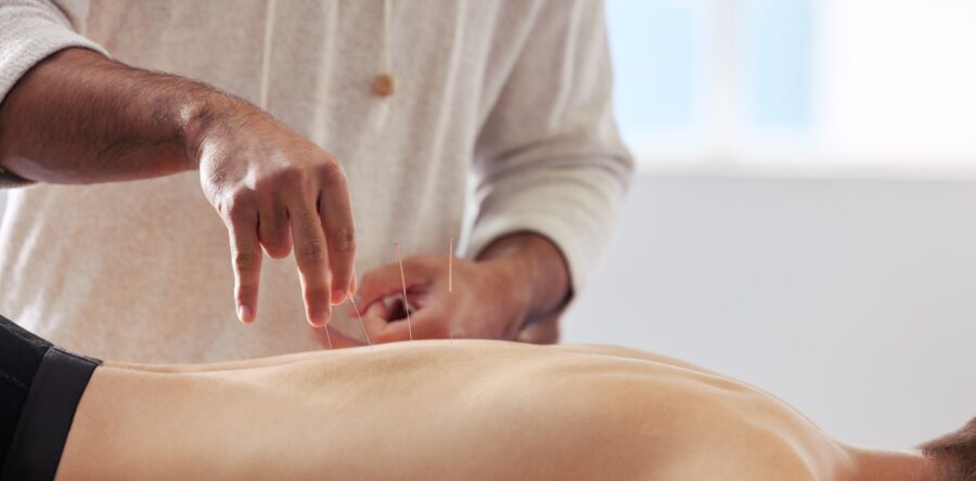 Treatment for Chronic Fatigue Syndrome: TCM and Acupuncture